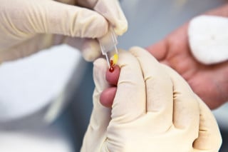 Pensione d'invalidità per i malati di AIDS
