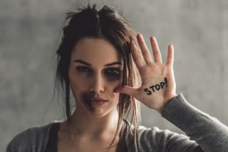 Lesioni permanenti al viso: troppo rigide le sanzioni