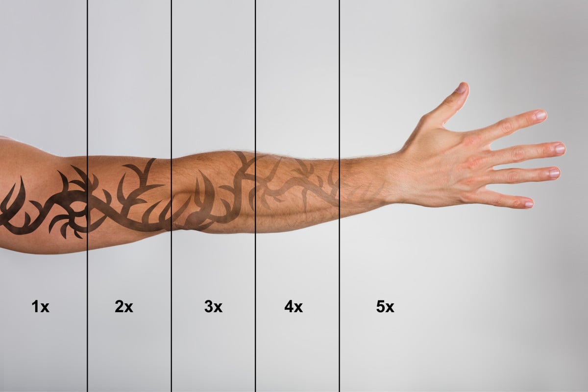 Escluso dal concorso per un tatuaggio: sì al risarcimento danni