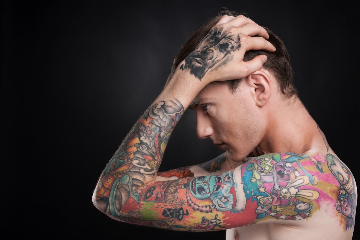 Niente colpa medica per la cicatrice da rimozione del tatuaggio