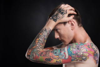Niente colpa medica per la cicatrice da rimozione del tatuaggio