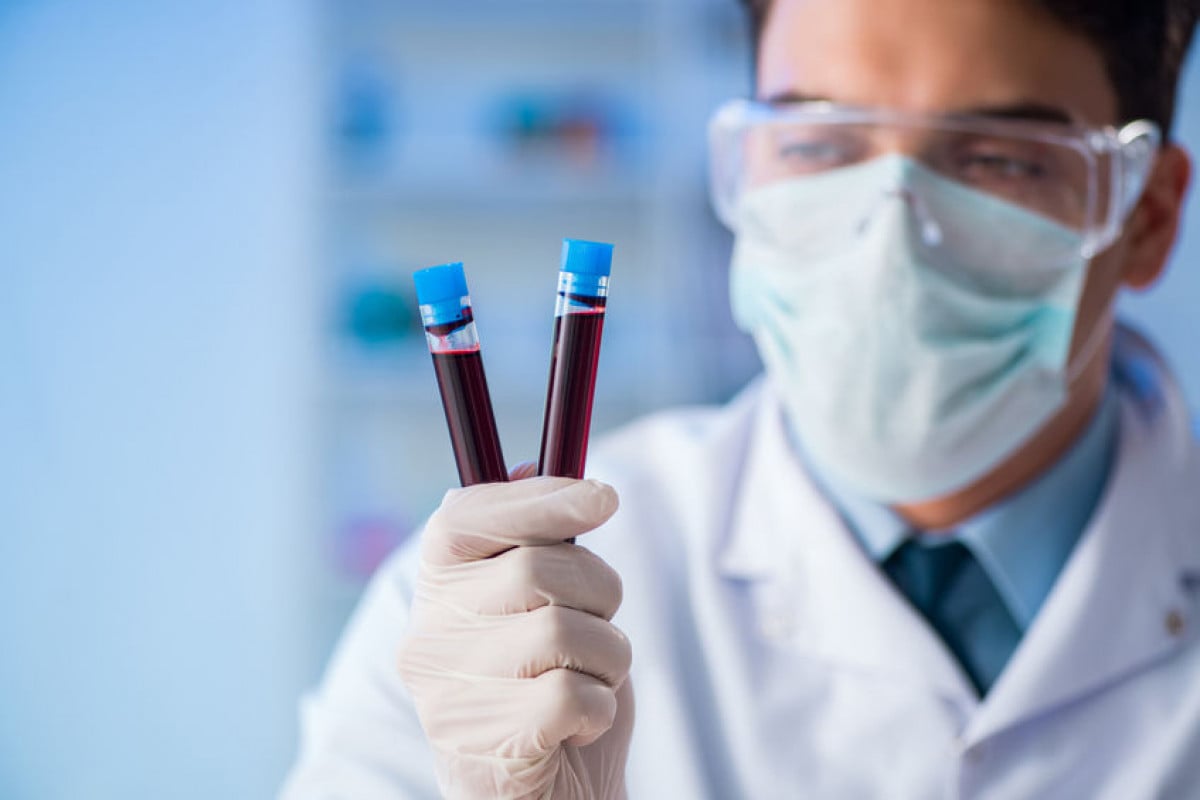 La gestione ottimale della talassemia in Sicilia